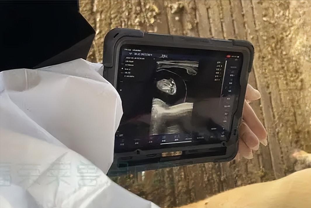 20岁女孩腹痛一个月，医生问有没有男朋友，她连说五遍“没有”。掀开衣服做B超，探