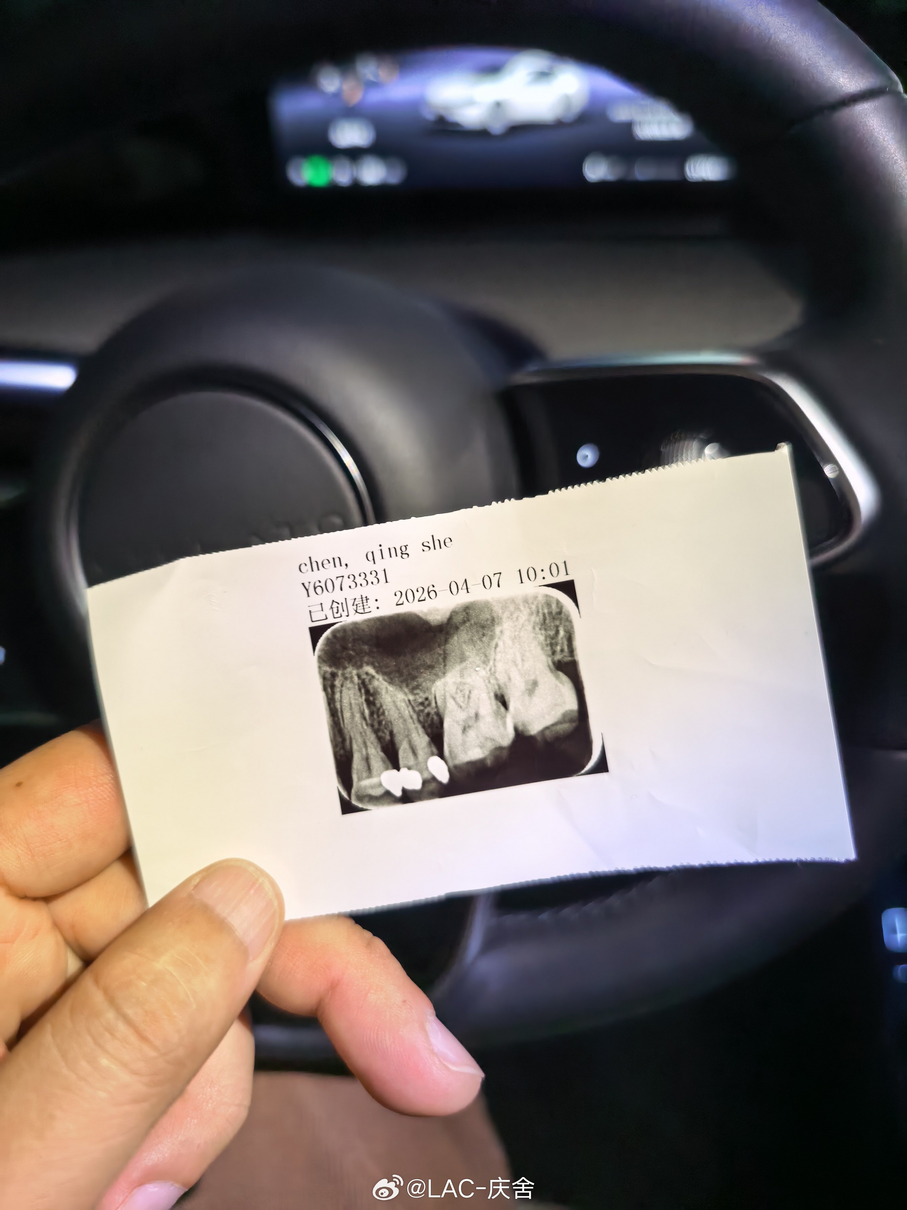 牙齿碎了半颗，挂了家附近全国知名的三甲医院。这个医院规模庞大，科室分得非常细，我