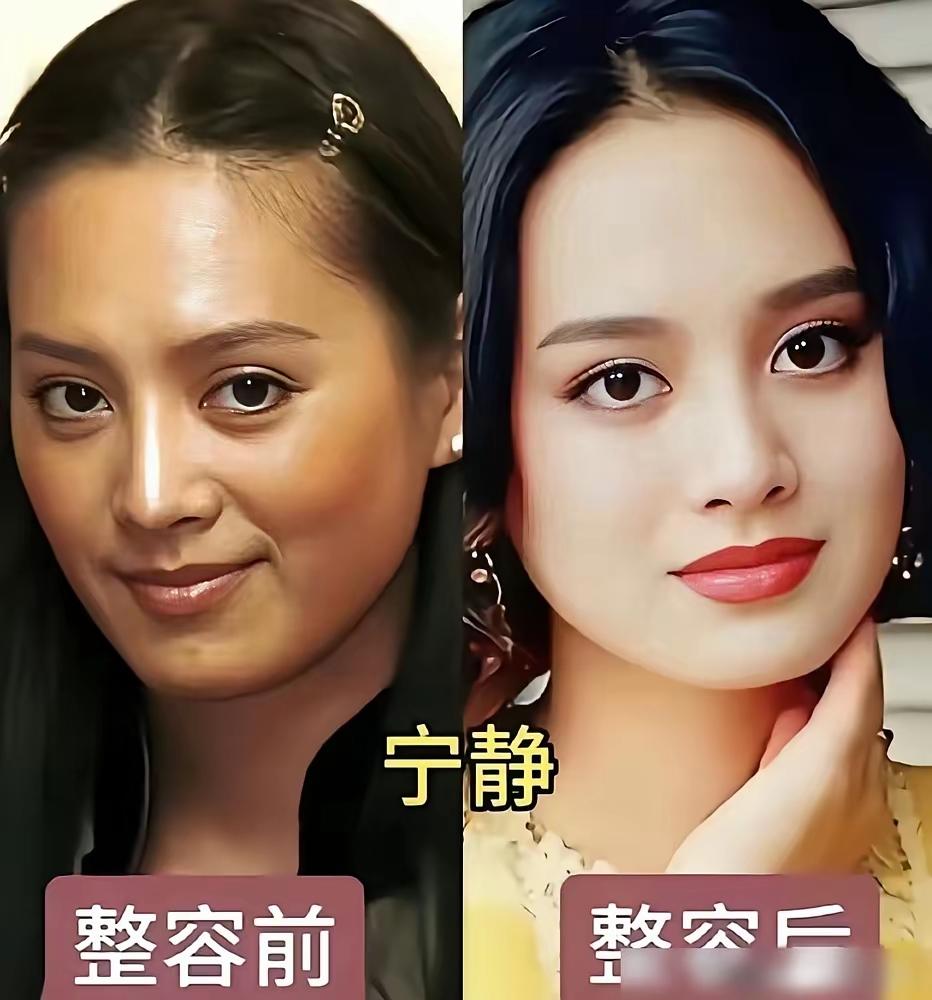 不是吧，人间富贵花，景甜也整过容吗？这颜值已经吊打一大众人了吧，居然也整了容，真