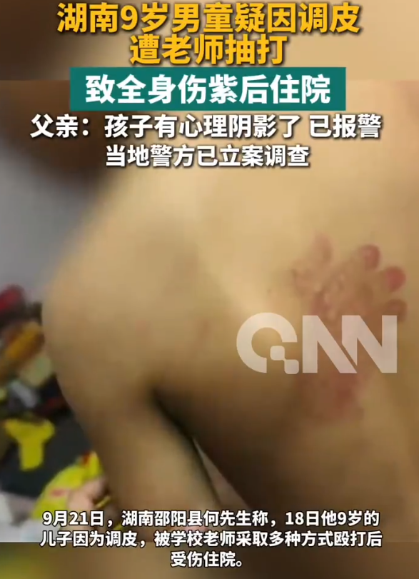 湖南，一个9岁男孩，因为调皮，被老师打进了医院。当天，男孩和班上5名同学用扎了孔的矿泉水瓶互相滋水玩
