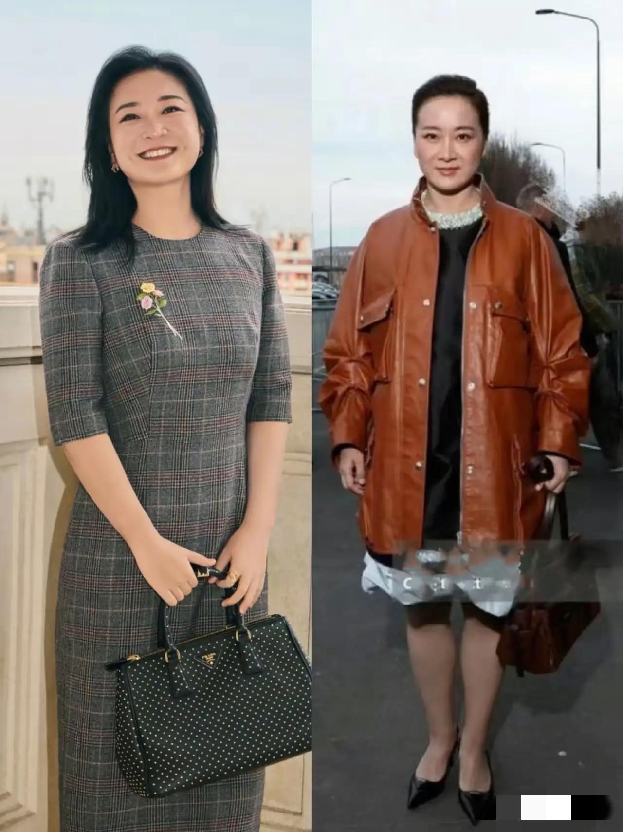 相由心生，贾玲面相真的变了！​她眼里的那道光，消失了。梨涡也与整容一起消失