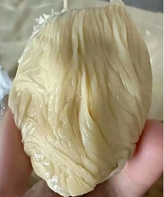 频繁生孩子的代价就是。。。​​​