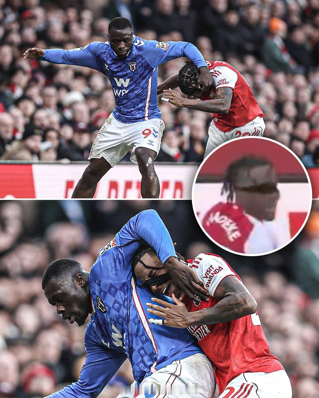 【英超球员靠身体吃饭】身体强壮的桑德兰前锋布罗贝，与阿森纳球员扛上了，跟萨利巴互