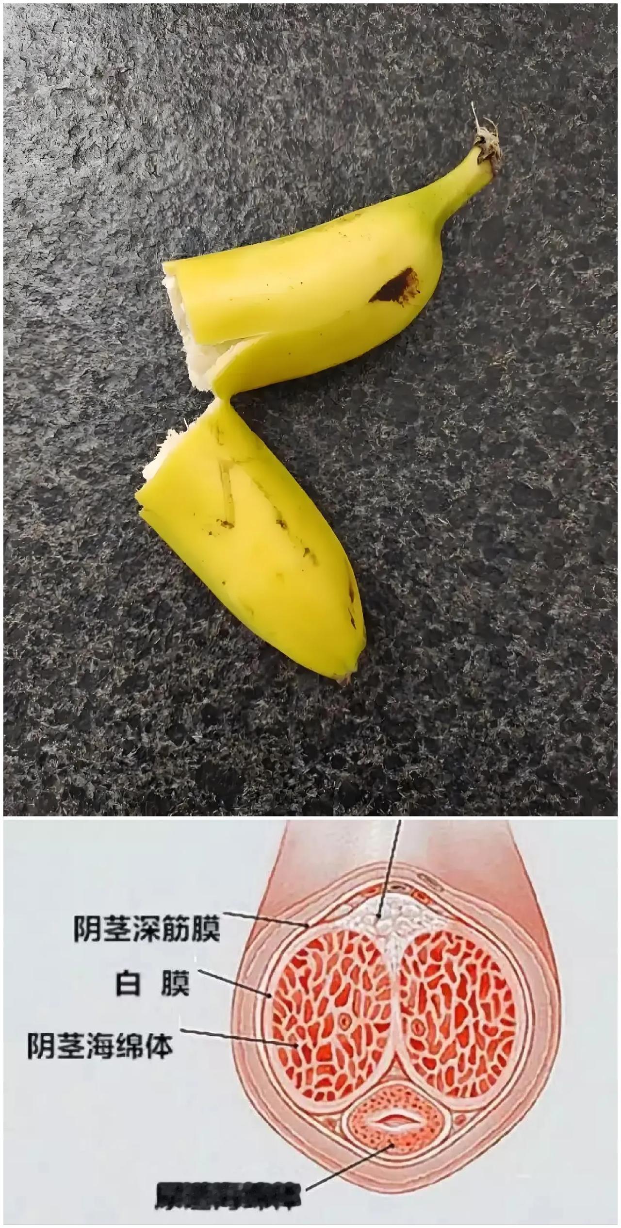 记住！[笑着哭]“丁丁”，也能骨折！有人问，骨折是因为有骨头，所以才能骨折，