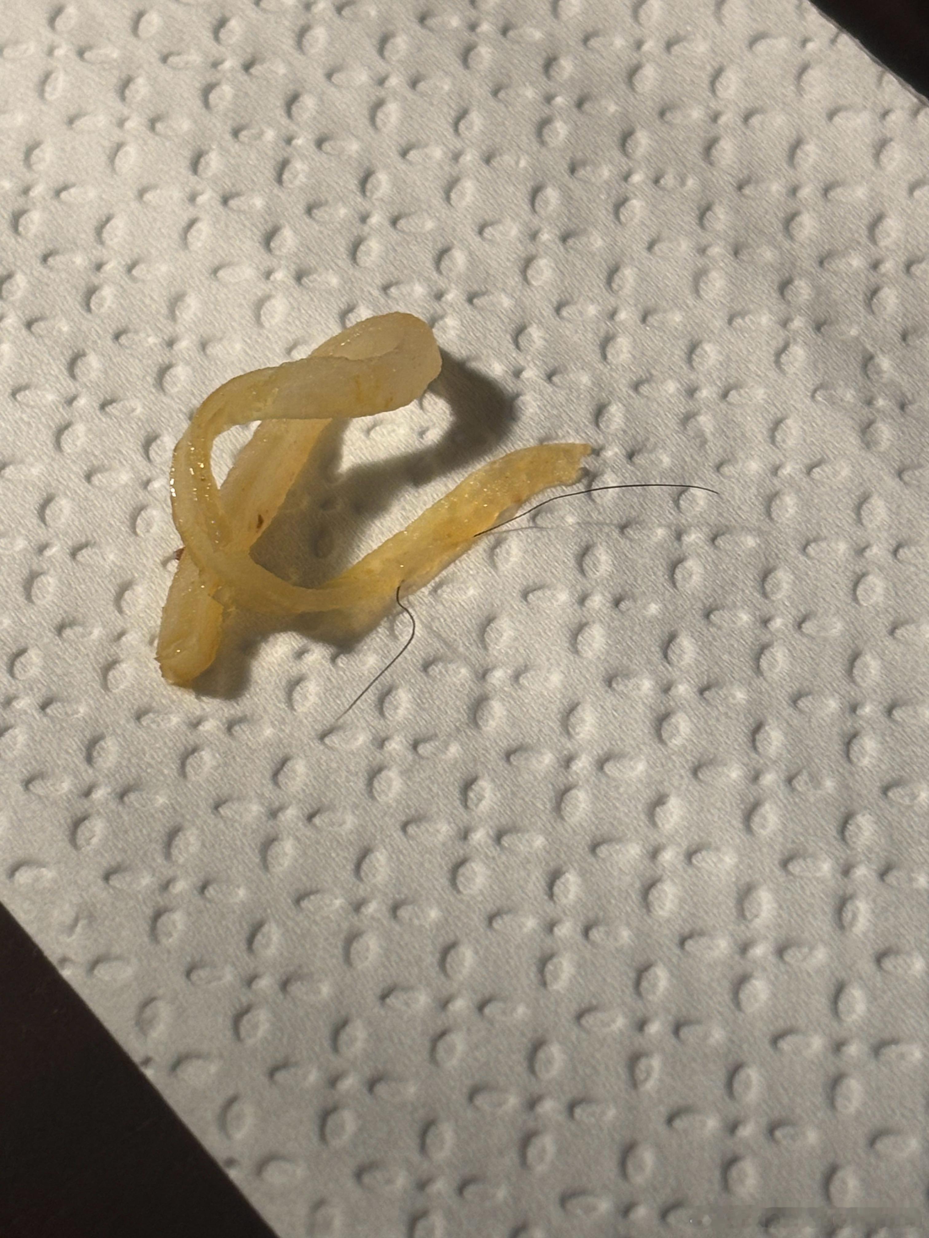 今天我在吃了7年的猪脚饭里面吃出了于是我在美团上拍照给老板，老板回复我“”。“我已经吃了七年了”“我