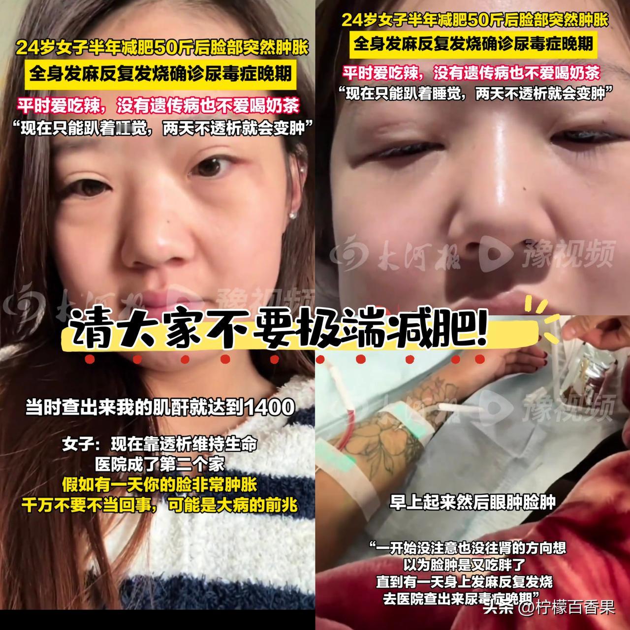 我的天！24岁姑娘半年减50斤，转头就查出尿毒症晚期，现在只能靠透析续命，连睡觉