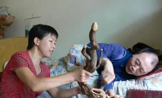 我们县太浮山区一村里，有一位年轻的女子，丈夫因帮别人修房子，从脚手架上掉下来，摔