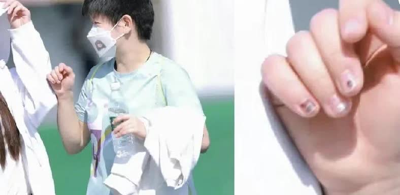 乍一看，以为莎莎精致起来了，居然做了美甲，细看心疼了!莎莎的手指甲盖竞布
