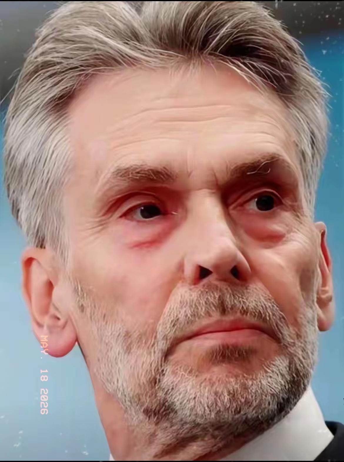美国按头，荷兰终于翻脸了。真爽！以前美国说啥荷兰都听着，现在荷兰直接甩脸子了