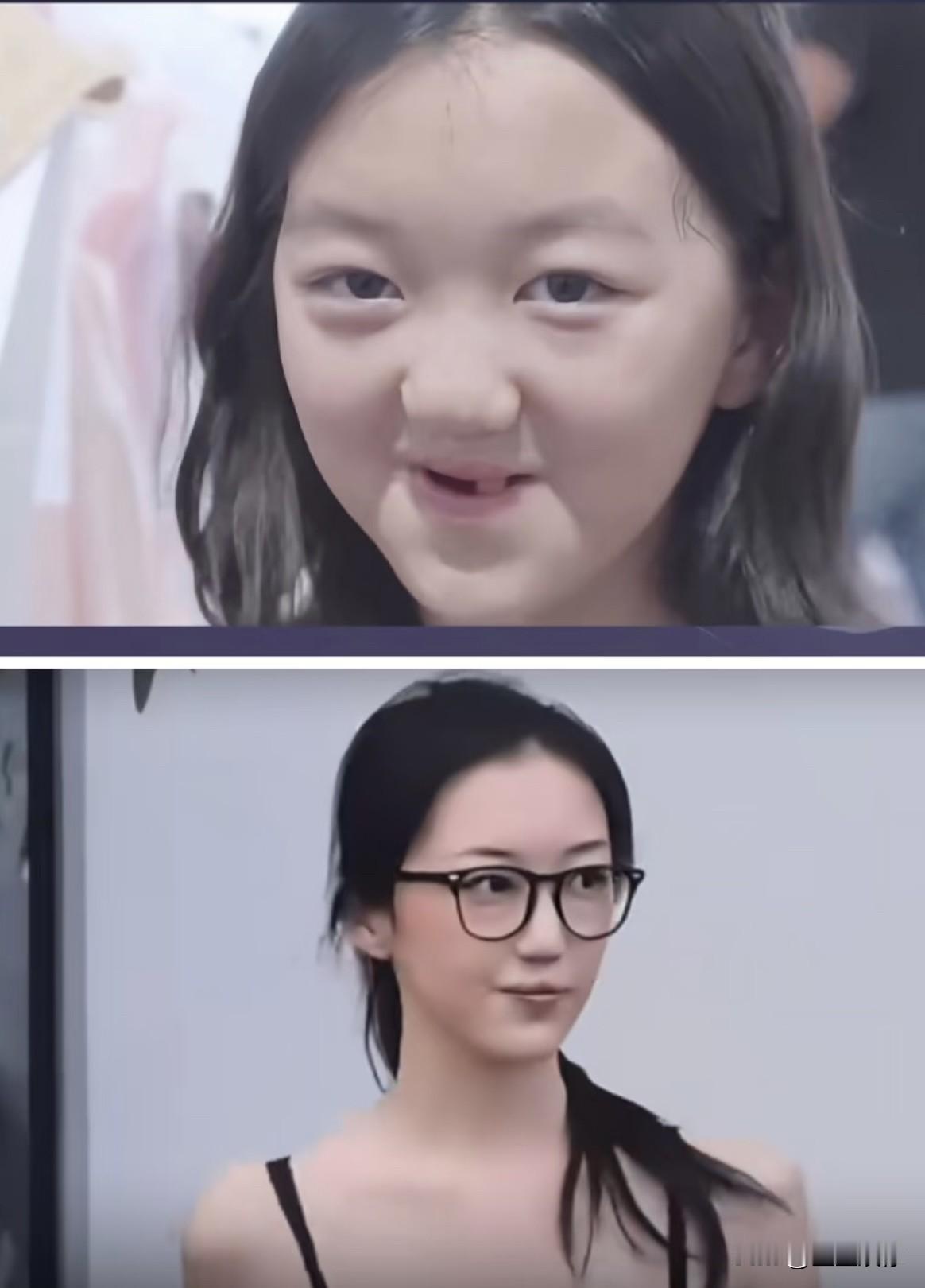 很多人只盯着李嫣的容貌，却忽略她带来的巨大善意。因为她的遭遇，让大众真正看见唇腭