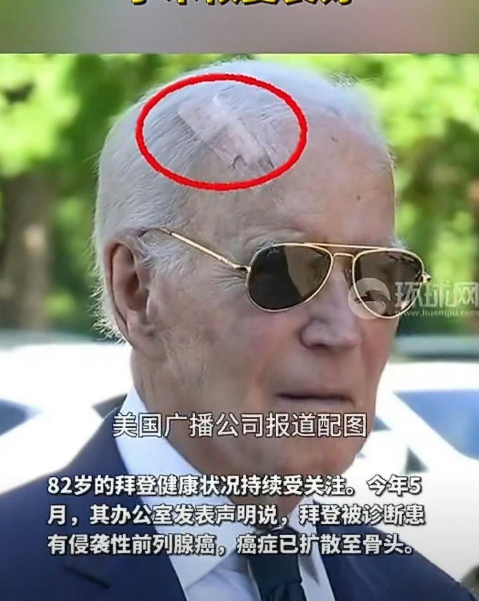 拜登癌症已扩散这个年纪了想吃什么就抓紧吃点吧​​​