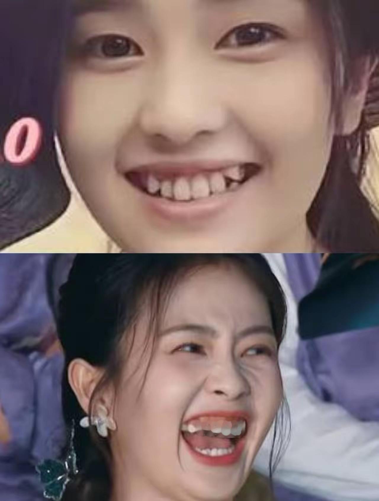 大笑露真容，同是原生乱牙，这俩谁更狠厉些？