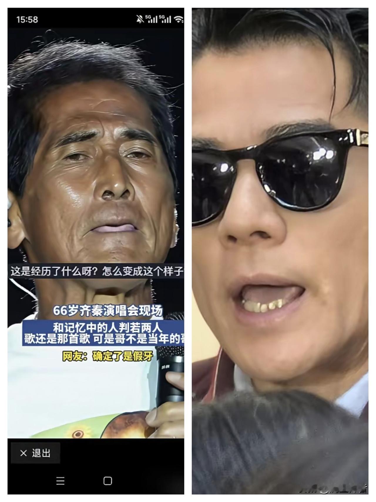 粉丝直呼齐秦怎么老成这样呢？郭富城60岁，齐秦66岁。一个在保养延缓衰老，一个自