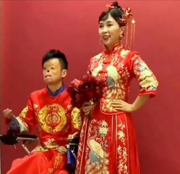 90后消防员在大火中救出女孩，他不幸重度烧伤，女孩不顾家人反对毅然嫁给了小伙。女