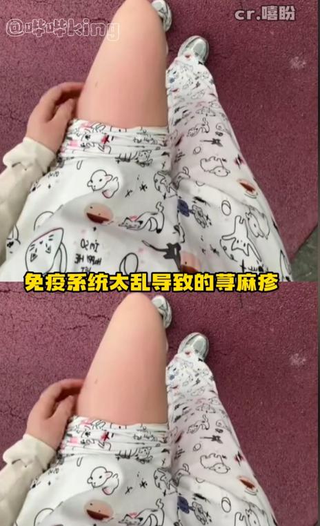 河南郑州，一女子到体育场跑步，才快走热身两圈，大腿突然一阵剧烈发痒。她忍不住抓了