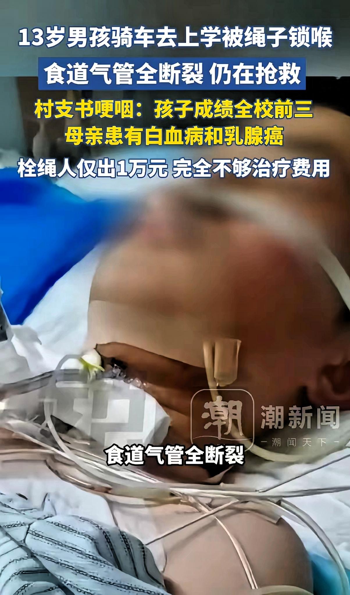 男孩骑车被绳叻倒伤势很重，律师发声！拴绳的老人恐难逃其责！13岁男孩不仅听话