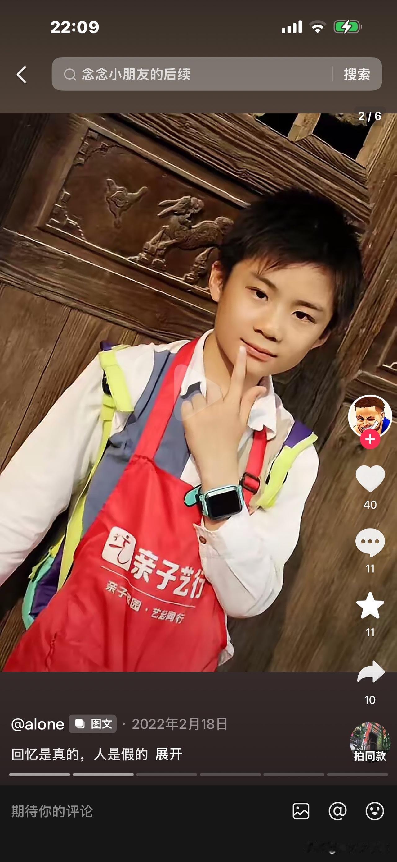 这孩子已不在了，走时12岁。如不出意外，现已长成17岁的英俊少年。爸爸缅怀：