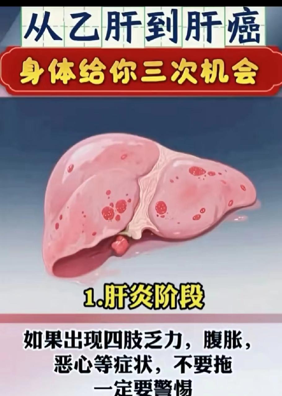 我国是肝病大国，乙肝和乙肝病毒携带者近1亿，占全球超1/3，且年轻患者比例上升。