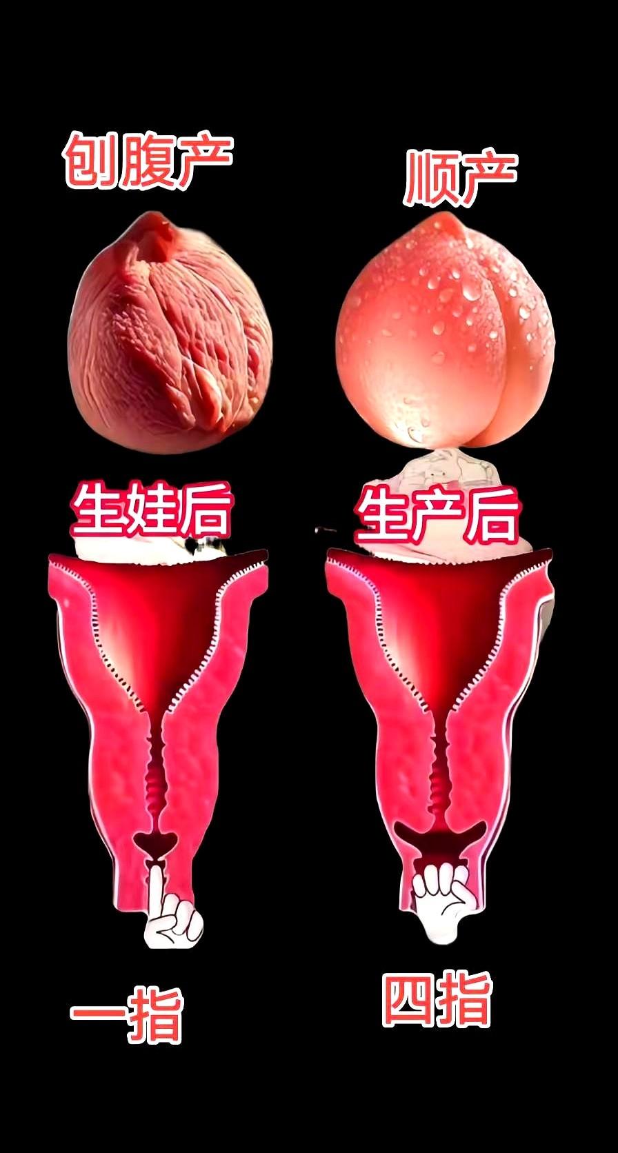 一个三胎宝妈经验告诉我，只有顺过的人才懂胯骨松垮垮的还漏，顺产的后遗症还真太多了