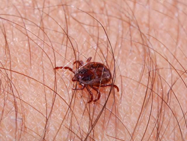 阴虱是什么? 为什么现在很多人得阴虱? 医生: 离不开3个传播途径