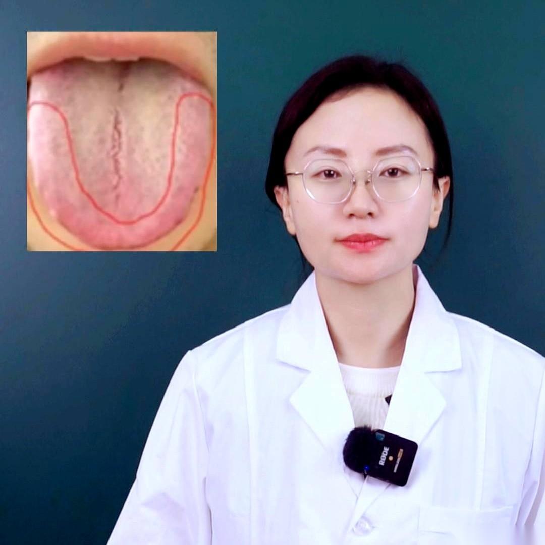 你身体里，肝是老板，脾是员工。记住了啊，这是天大的秘密。你老板天天拉着个脸，