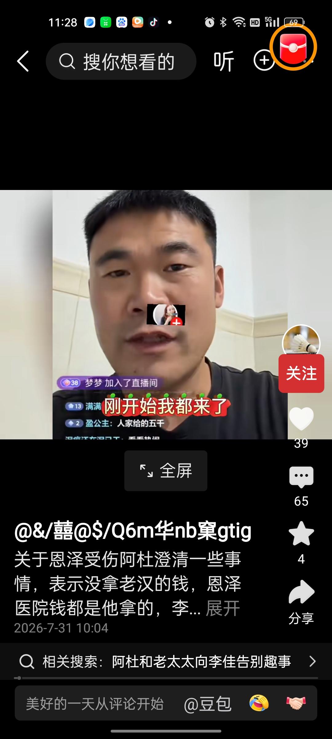 这或许才是李佳和阿杜过日子的真实状况，恩泽腿受伤是真，现在看到他们三口在医院和谐