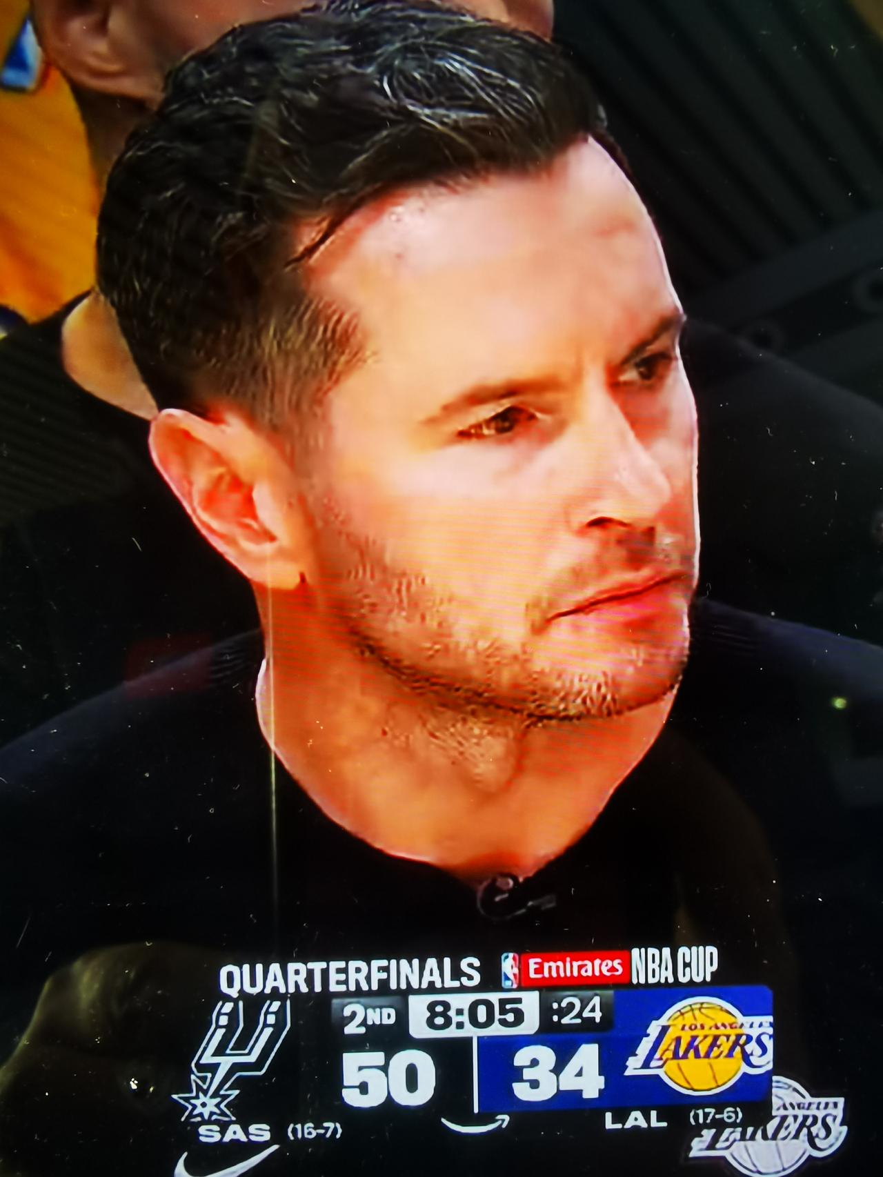 难以抉择的雷迪克湖人119-132，主场输给马刺。最近5场，