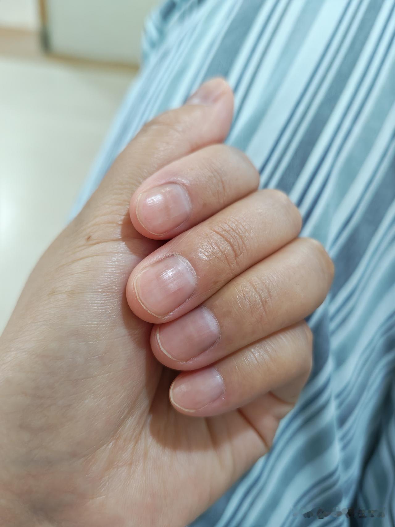 这四个月一边上班一边治病，经过手术，化疗到现在放疗，虽然体重没下降，可感觉身体被