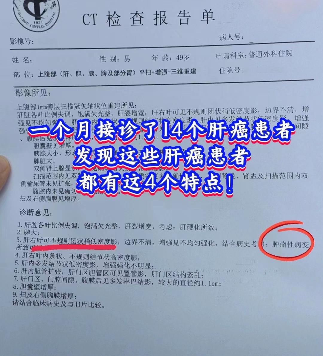 一个月接诊14个肝癌患者，个个都让人心疼！发现他们身上都有 4个共同点...