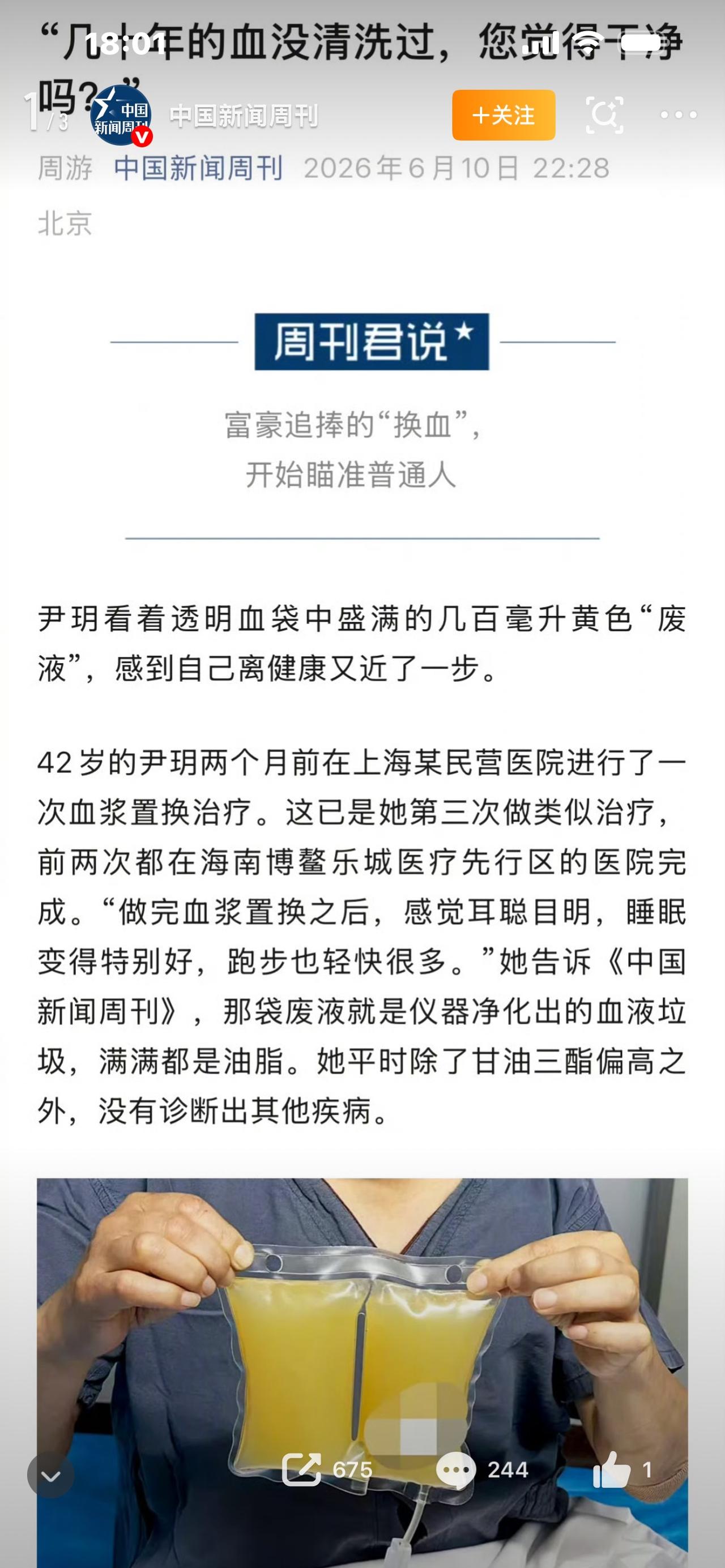 富豪“换血续命”，现在开始收割普通人！社会热点你敢信吗？曾经硅谷富豪专属的“