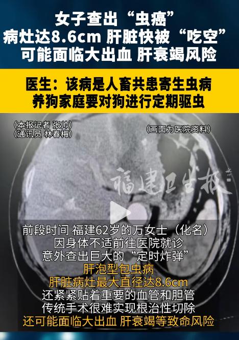 “给所有养宠家庭敲醒警钟！”福建62岁万女士因长期与宠物亲密接触、忽视卫生，身体