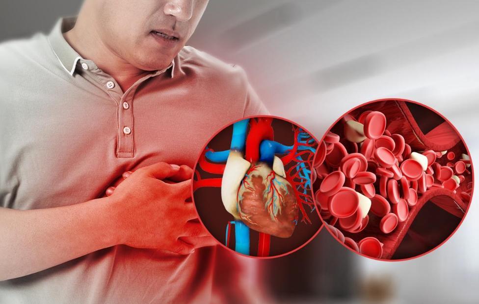 血枯、血浊、血瘀！3种血脏问题，对应3个中成药，血管干净少生病大家好，我