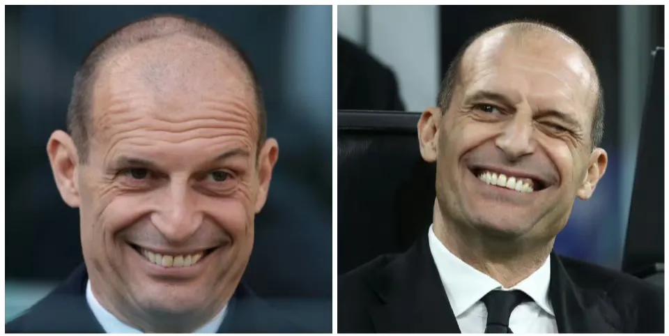 对都灵赛前，国米中场恰尔汉奥卢再受伤！紧跟着，AC米兰的大核莫德里奇也大伤！！看