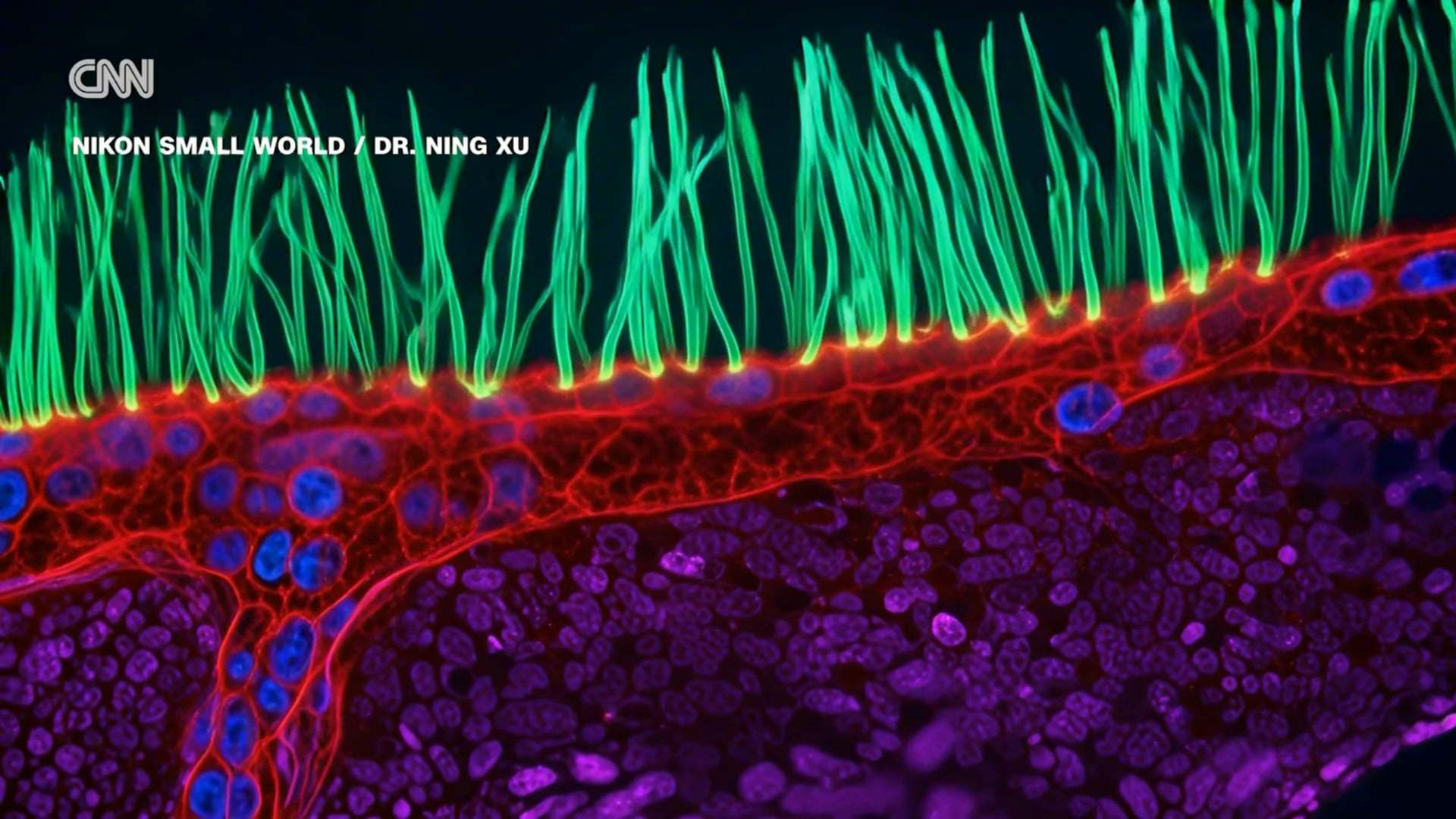 一段显微镜视频拿下了国际大赛的冠军，画面里却有一团生物学里不存在的东西。这段视频