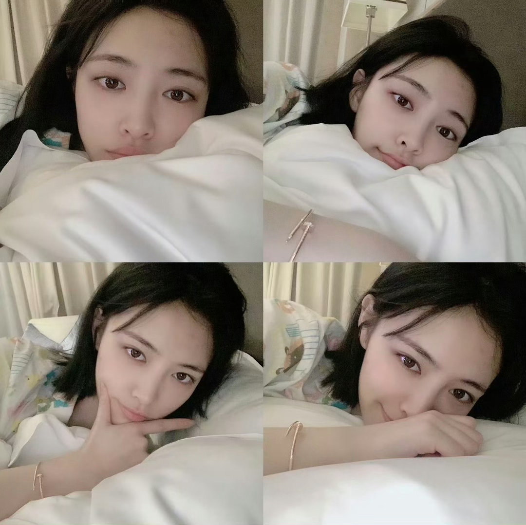 请许佳琪正视自己的颜值有多伟大