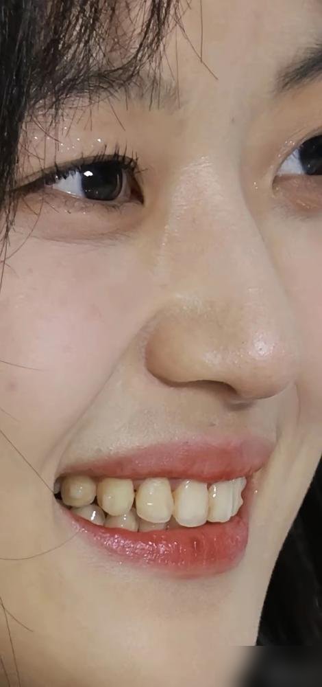 孙千那口牙终于有人夸了。这几年电视剧里女演员一张嘴全是锃亮的大白牙，白到反光，假得人出戏。孙千在《早