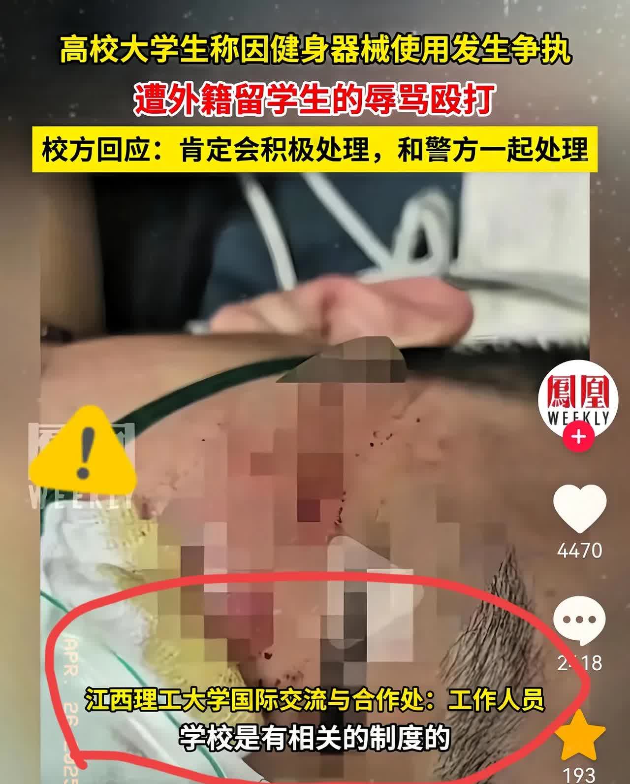 江西理工大学我们学生被留学生打了！看到江西理工大学学生被留学生打的新闻，