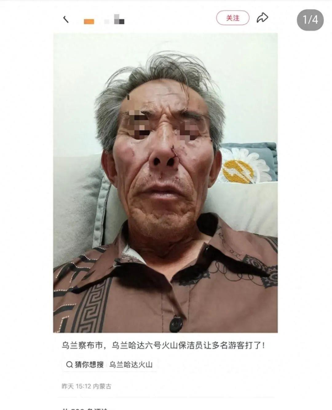 内蒙古，一68岁的保洁员因劝阻游客不要乱扔烟雾棒，竟遭多人围殴，对方不仅用烟雾棒