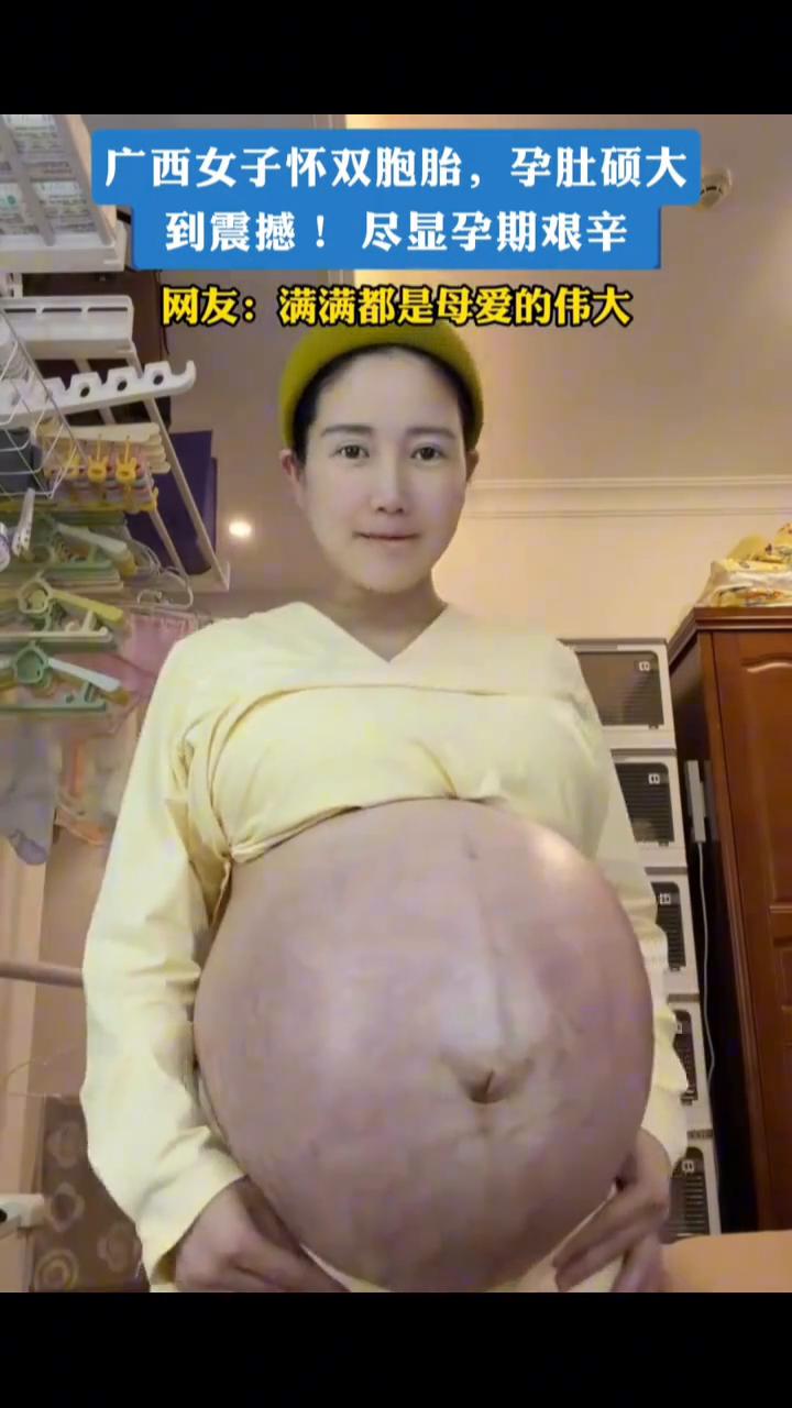 广西女子怀双胞胎，孕肚硕大到震撼！尽显孕期艰辛。网友：满满都是母爱的伟大。4月
