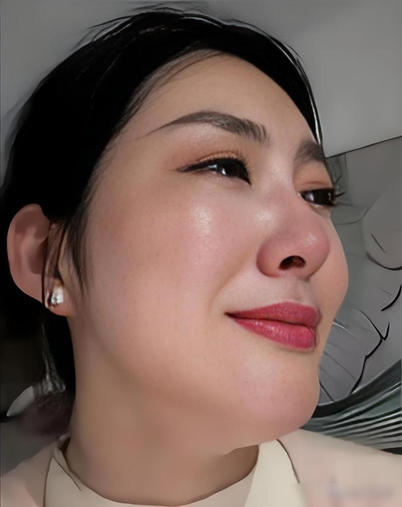 大家有没有发现现在脑出血的人群越来越年轻化了？前阵子我还听小区里闲聊说，楼下35
