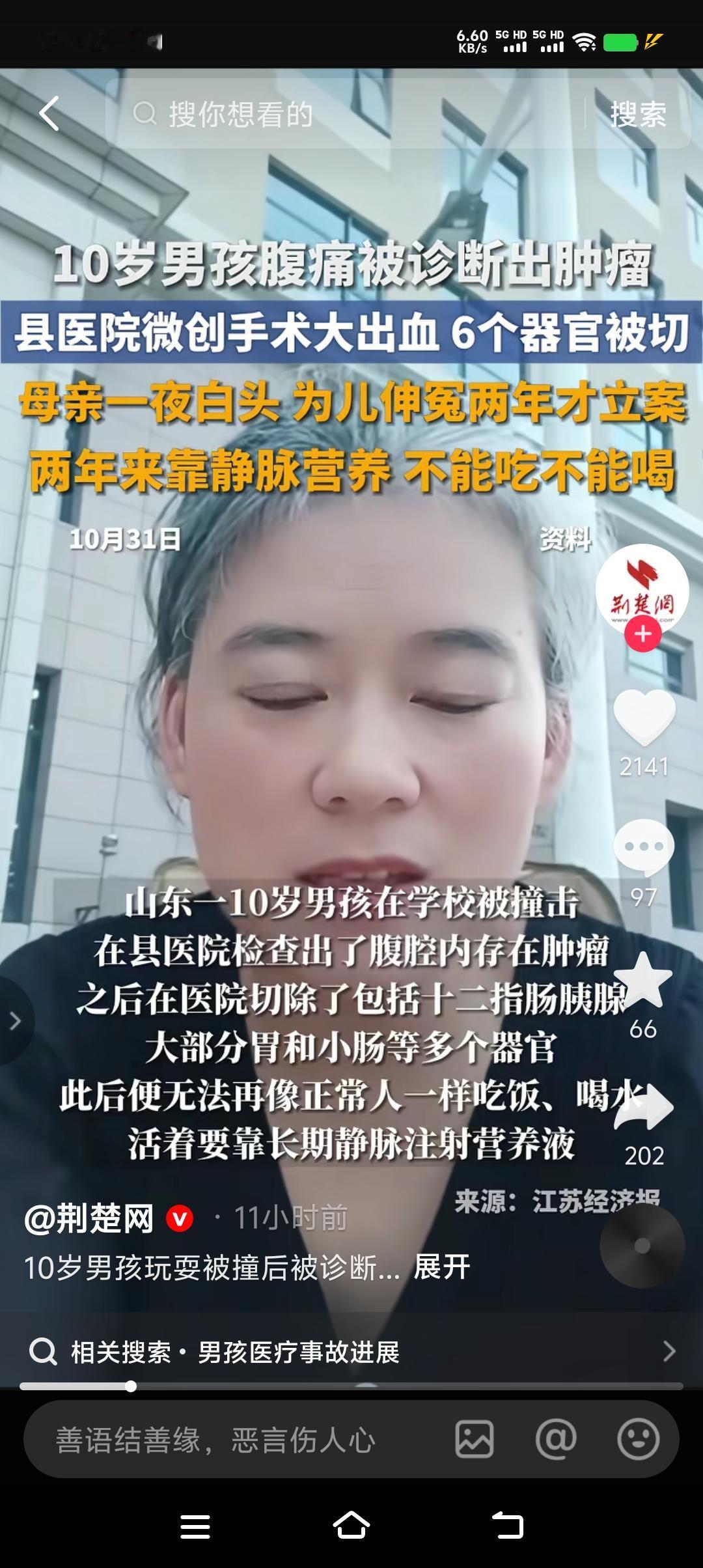 微创手术最后做成了清创手术,10岁男孩的腹腔几乎全部清干净,十二指肠、小肠、胰腺