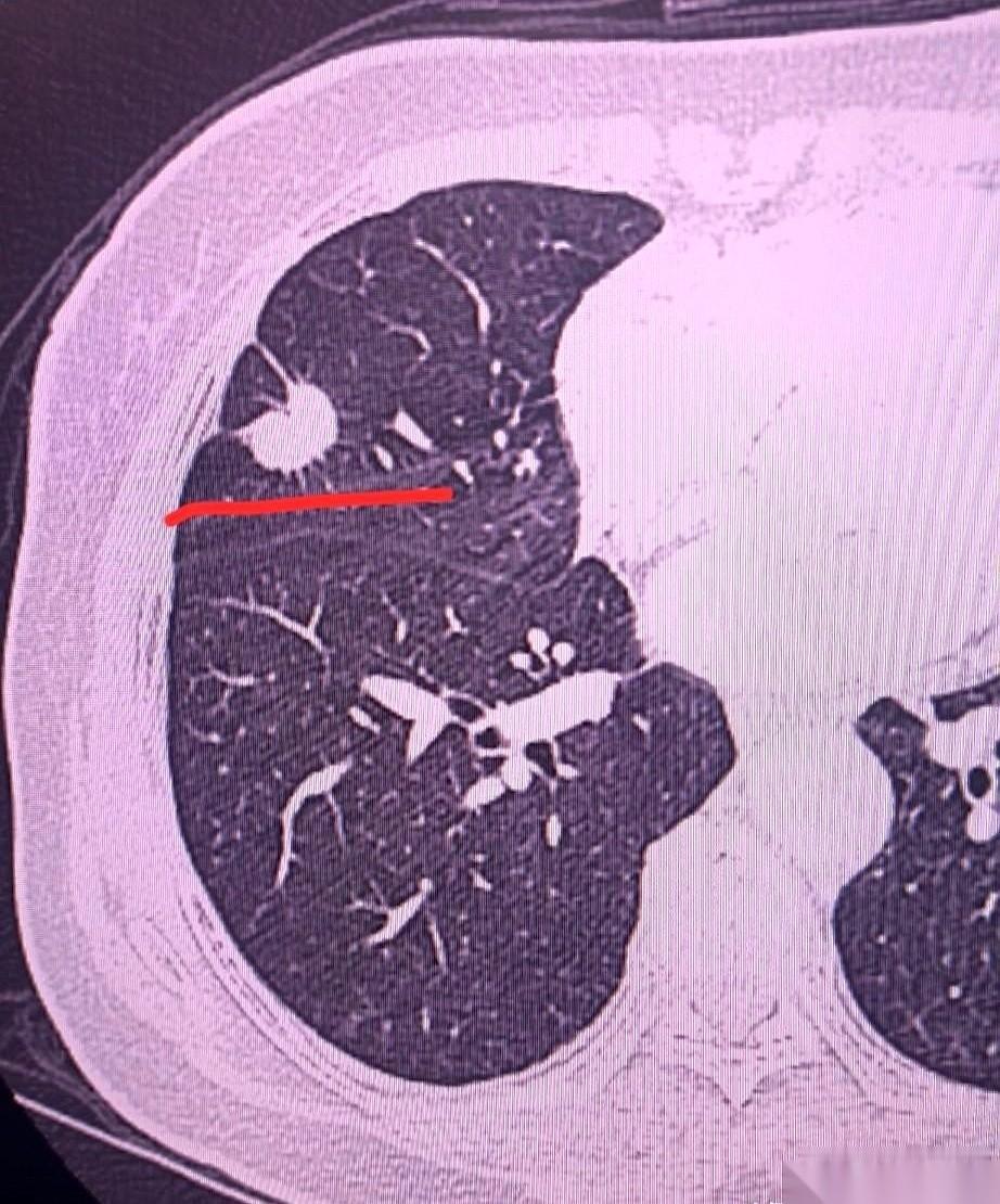 要不是这场甲流，我们单位的郭主任，可能真就奔着“鞠躬尽瘁”去了。字面意思的那种