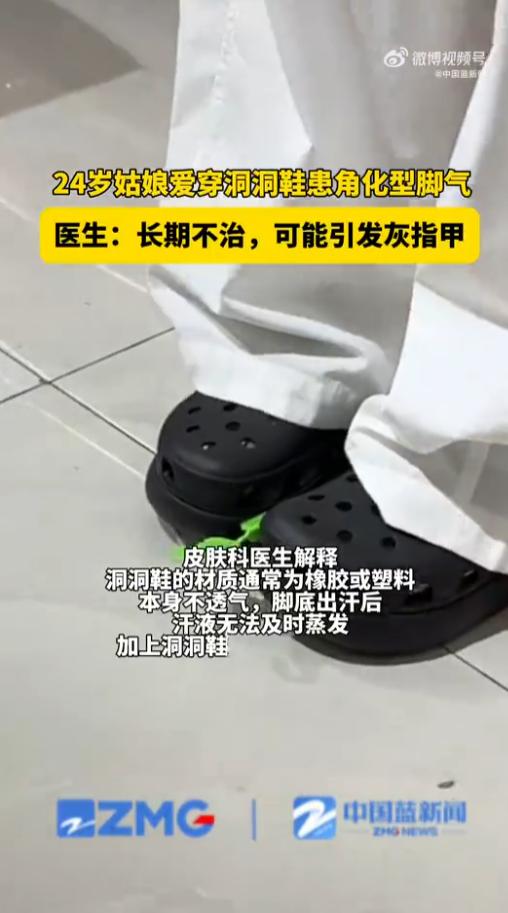 这个是真没想到！一女子觉得洞洞鞋又方便又凉快，几乎整个夏天都穿着。起初她只是觉得