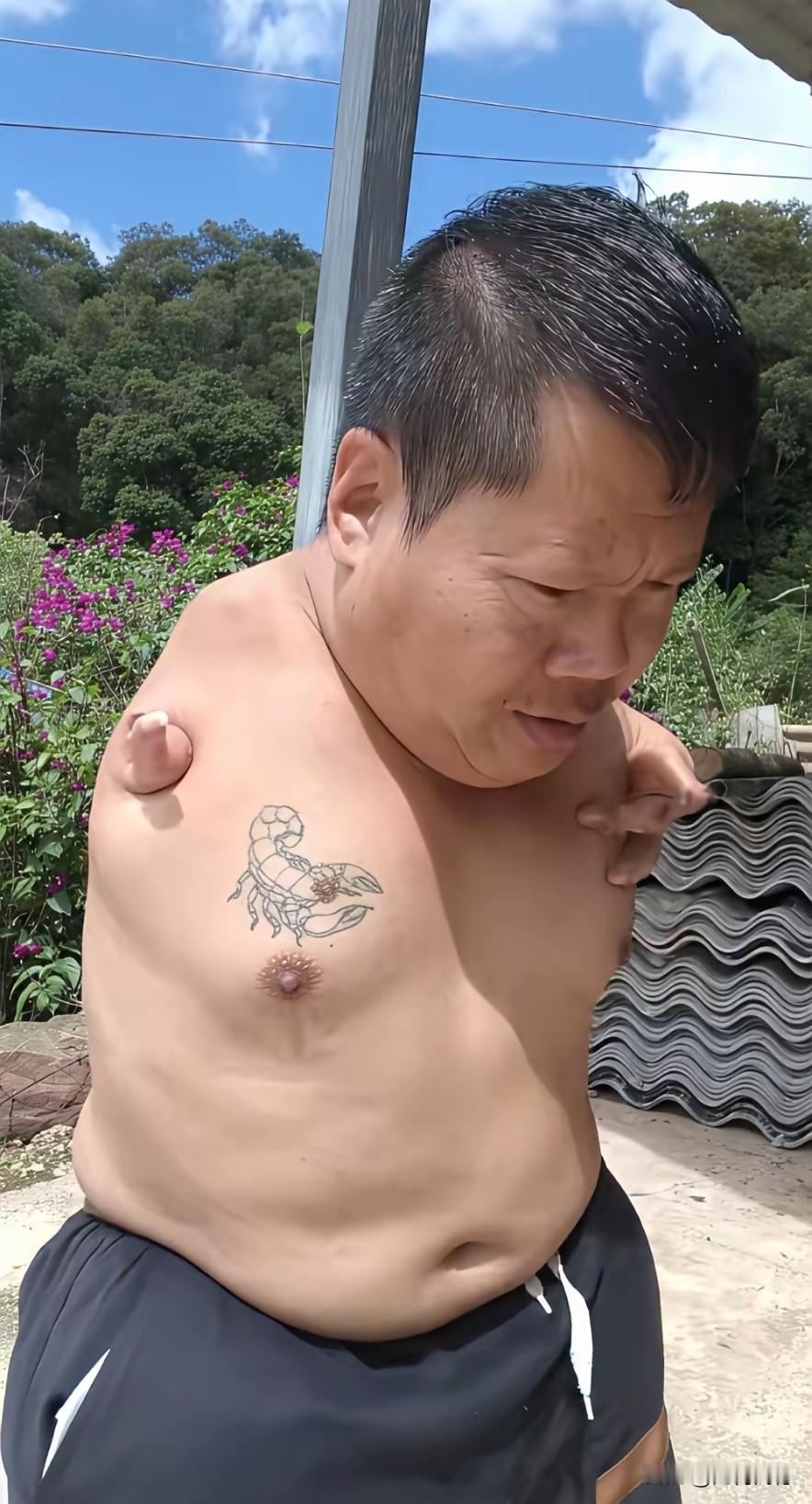 这个人的身体很壮实，但是他的两只手，包括他的胳膊，也许是先天发育不良，没有胳膊也