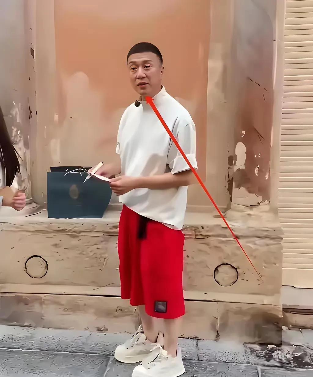 哦豁！孙红雷也去割双眼皮了，但总感觉怪怪的。本来一双小眼睛是他的标签，这突然变