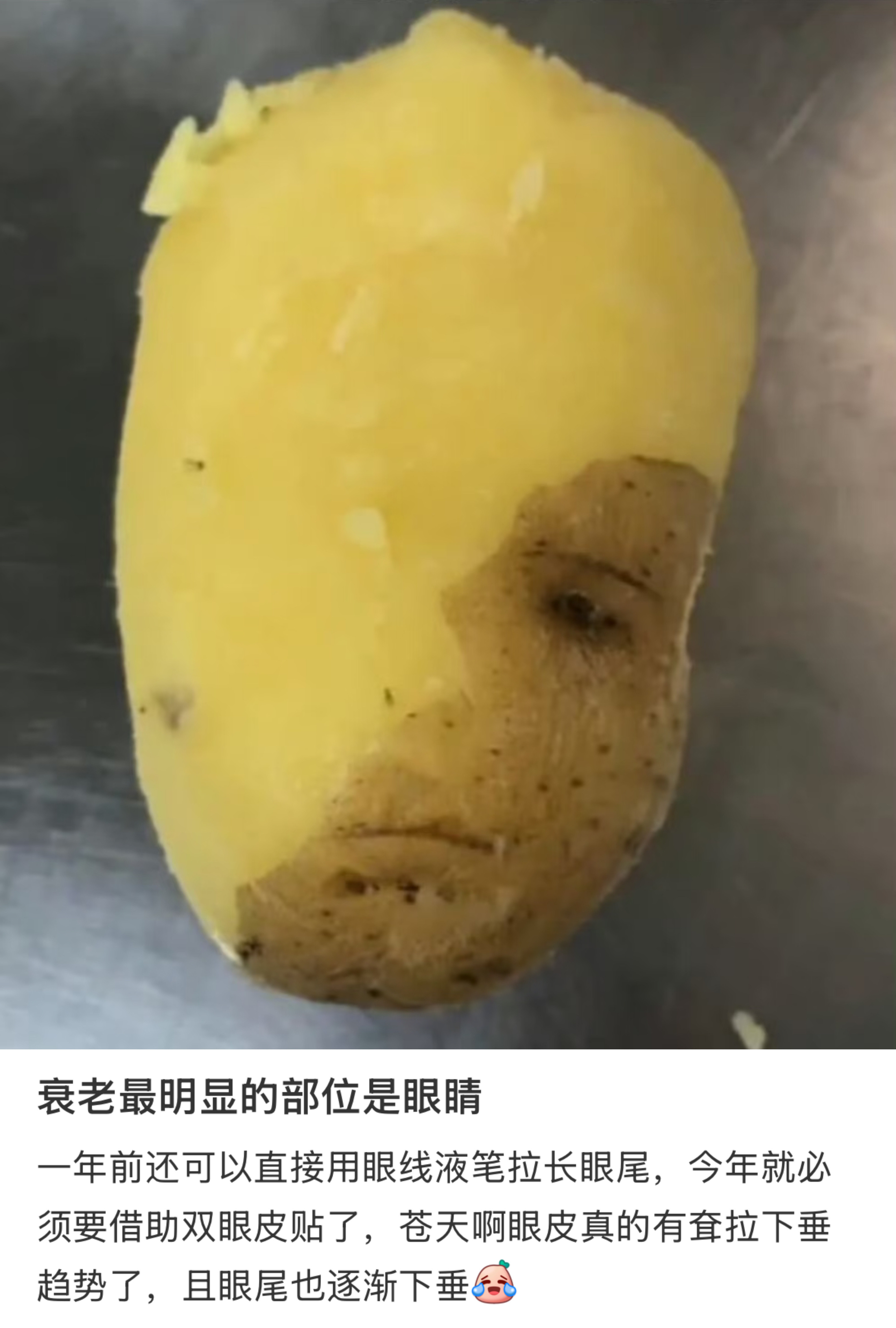 衰老最明显的部位是眼睛