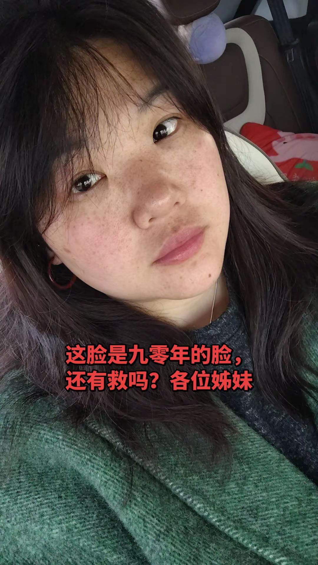 连我妈妈都嫌弃我这张脸了