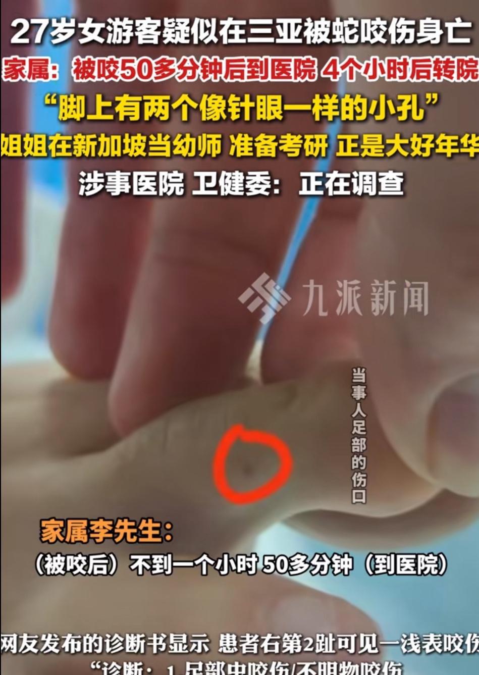 27岁女子在三亚被蛇咬身亡，看了她去医院就诊的过程！我真的有理由怀疑，接诊她的