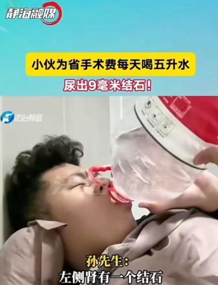 2025年2月2日，一名26岁的山东小伙，竟然排出了一颗约9毫米的肾结石。为了省