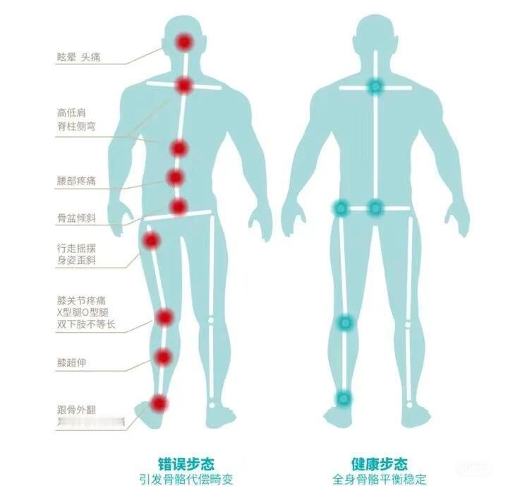 ⚠️运动总受伤？可能是你的“身体力线”歪了！姐妹们！有没有发现运动时总是膝盖疼